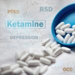 Ketamine: top 4 questions answered